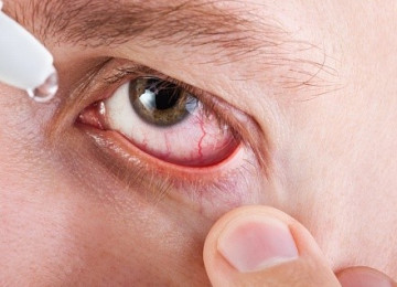 Растет число людей, страдающих синдромом сухого глаза – все о зрении