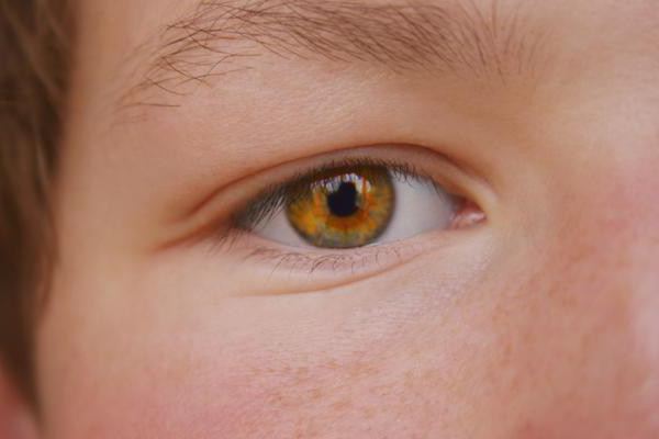 Если глаз опух: диагностика и рекомендации – все о зрении