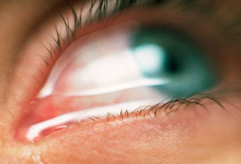 Глазные капли при травме глаз – все о зрении