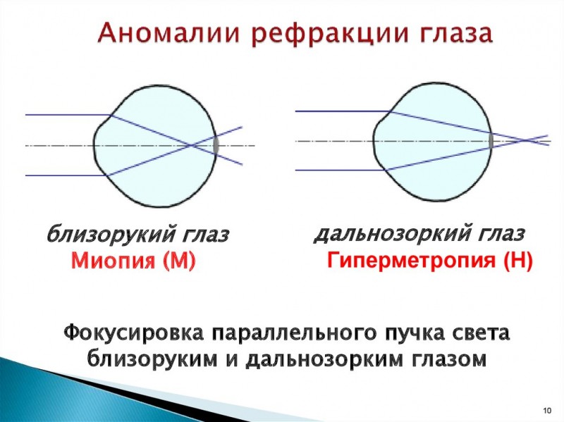 Схема рефракции нормального глаза